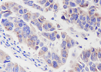 FAF2 Recombinant Mouse Monoclonal Antibody