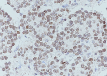 Acetyl-Histone H3 (Lys18) Mouse Monoclonal Antibody