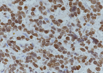 Acetyl-Histone H4 (Lys12) Rabbit Polyclonal Antibody