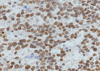 Acetyl-Histone H3 (Lys36) Rabbit Polyclonal Antibody