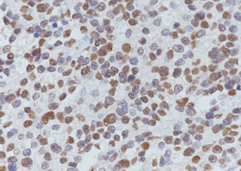 Acetyl-Histone H3 (Lys14) Mouse Monoclonal Antibody