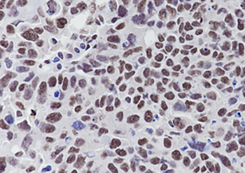 TRIM24 Recombinant Mouse Monoclonal Antibody