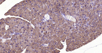 ALDH1L1 Recombinant Rabbit Monoclonal Antibody