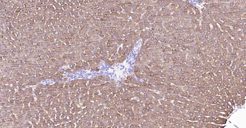 ALDH1L1 Recombinant Rabbit Monoclonal Antibody