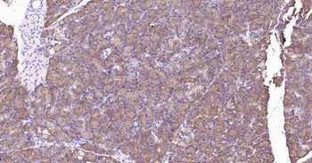 ALDH1L1 Recombinant Rabbit Monoclonal Antibody