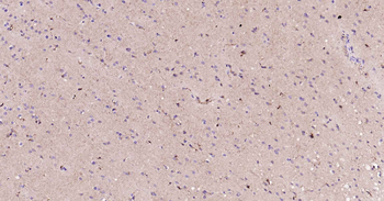 ALDH1L1 Recombinant Rabbit Monoclonal Antibody