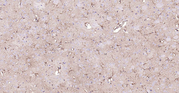 ALDH1L1 Recombinant Rabbit Monoclonal Antibody