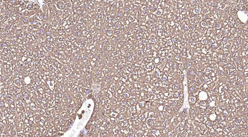 ALDH1L1 Recombinant Rabbit Monoclonal Antibody