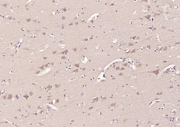 MFN1 Recombinant Mouse Monoclonal Antibody