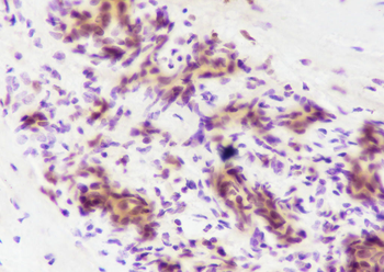 SBDS Recombinant Mouse Monoclonal Antibody