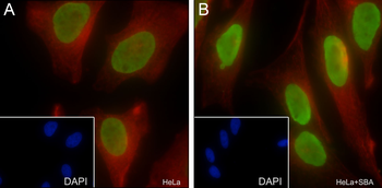 Acetyl-Histone H3 (Lys14) Recombinant Rabbit Monoclonal Antibody