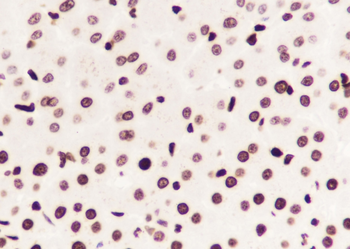 Acetyl-Histone H3 (Lys14) Recombinant Rabbit Monoclonal Antibody