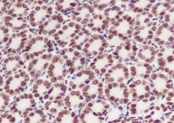 Acetyl-Histone H3 (Lys14) Recombinant Rabbit Monoclonal Antibody