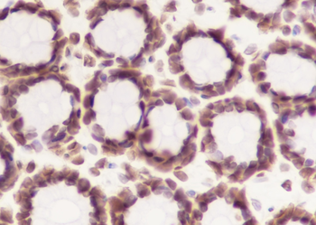 Acetyl-Histone H3 (Lys14) Recombinant Rabbit Monoclonal Antibody