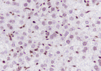 Mono-Methyl-Histone H3 (Lys4) Recombinant Mouse Monoclonal Antibody