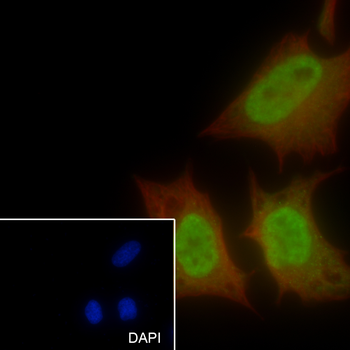 SF1 Recombinant Rabbit Monoclonal Antibody