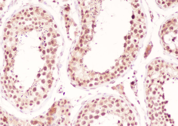 SF1 Recombinant Rabbit Monoclonal Antibody
