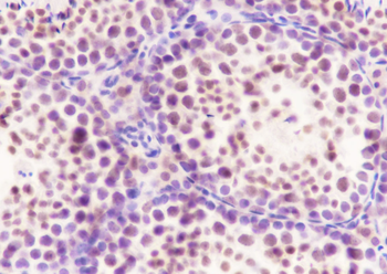 SF1 Recombinant Rabbit Monoclonal Antibody