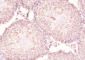 SF1 Recombinant Rabbit Monoclonal Antibody