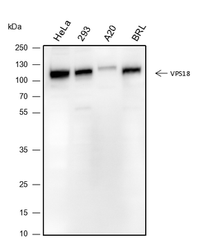 VPS18 Recombinant Mouse Monoclonal Antibody