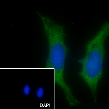 VPS18 Recombinant Mouse Monoclonal Antibody