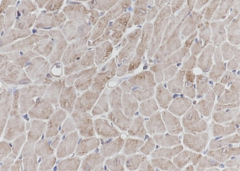 VPS18 Recombinant Mouse Monoclonal Antibody