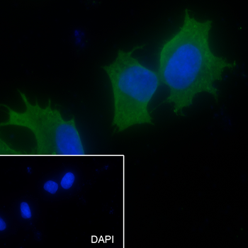 TOMM40 Recombinant Mouse Monoclonal Antibody