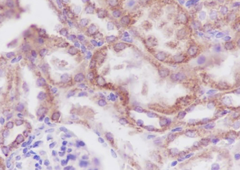 TOMM40 Recombinant Mouse Monoclonal Antibody