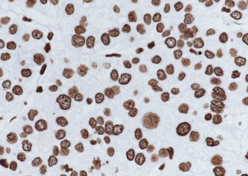 Di-Methyl-Histone H3 (Lys27) Recombinant Rabbit Monoclonal Antibody