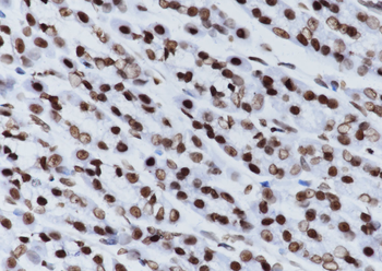 Di-Methyl-Histone H3 (Lys27) Recombinant Rabbit Monoclonal Antibody