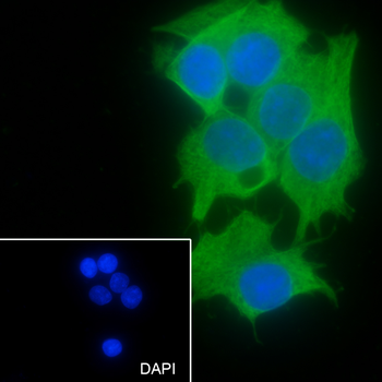 GPI Recombinant Mouse Monoclonal Antibody