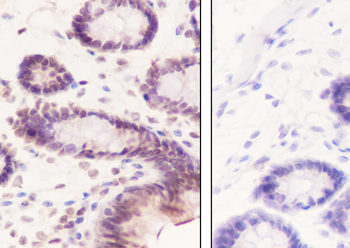 Β-Hydroxybutyryl-Histone H3 (Lys9) Recombinant Rabbit Monoclonal Antibody