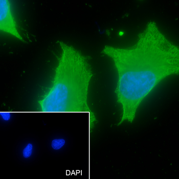 Calumenin Recombinant Mouse Monoclonal Antibody