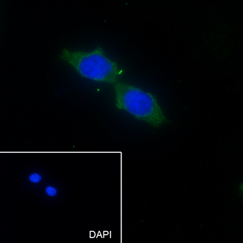 LACTB Recombinant Mouse Monoclonal Antibody