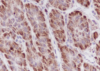 LACTB Recombinant Mouse Monoclonal Antibody