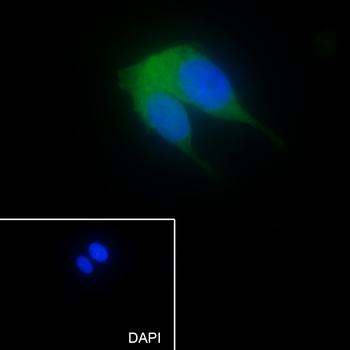 NDRG2 Recombinant Mouse Monoclonal Antibody