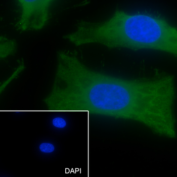 GPNMB Recombinant Mouse Monoclonal Antibody