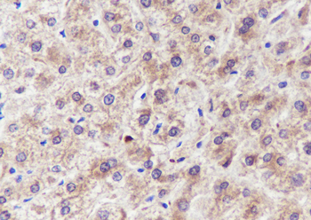 GPNMB Recombinant Mouse Monoclonal Antibody