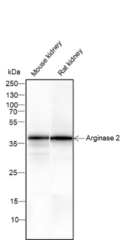 Arginase2 Recombinant Mouse Monoclonal Antibody