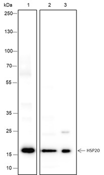 HSPB6 Recombinant Mouse Monoclonal Antibody
