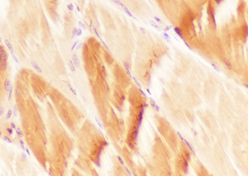 HSPB6 Recombinant Mouse Monoclonal Antibody