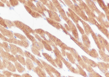HSPB6 Recombinant Mouse Monoclonal Antibody