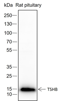 TSHB Recombinant Rabbit Monoclonal Antibody