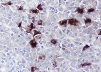 TSHB Recombinant Rabbit Monoclonal Antibody