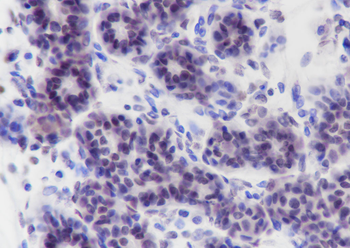 Crotonyl-Histone H2B (Lys11) Recombinant Rabbit Monoclonal Antibody