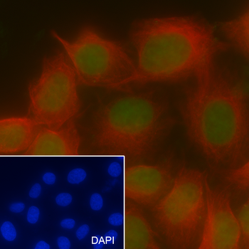 Mono-Methyl-Histone H3 (Lys27) Mouse Monoclonal Antibody