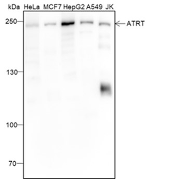 ATR Mouse Monoclonal Antibody