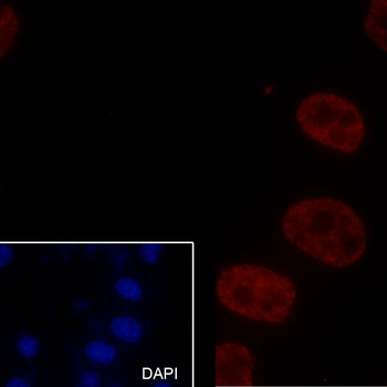 Mono-Methyl-Histone H3 (Lys36) Rabbit Polyclonal Antibody