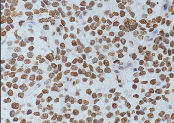 Tri-Methyl-Histone H3 (Lys27) Mouse Monoclonal Antibody