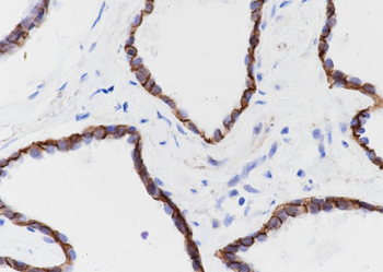 CTNND1 Recombinant Rabbit Monoclonal Antibody